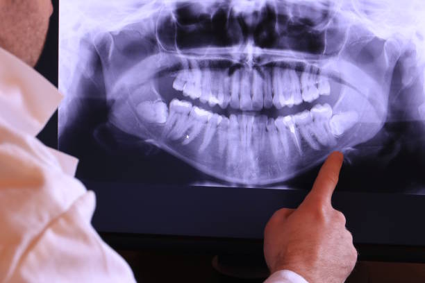 Best Broken or Chipped Tooth Repair in Winfield, IA