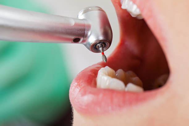 Best Emergency Treatment for Oral Infections in Winfield, IA